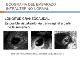 ECOGRAFIA DEL EMBARAZO
INTRAUTERINO NORMAL
LONGITUD CRANEOCAUDAL.
Es posible visualizarlo vía transvaginal a partir
de la semana 5.
POR VIA TRANSABDOMINAL A PARTIR DE LA SEMANA 6
 