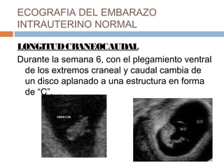 ECOGRAFIA DEL EMBARAZO
INTRAUTERINO NORMAL
LONGITUDCRANEOCAUDAL
Durante la semana 6, con el plegamiento ventral
de los extremos craneal y caudal cambia de
un disco aplanado a una estructura en forma
de “C”.
 