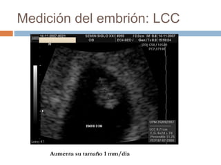Medición del embrión: LCC
Aumenta su tamaño 1 mm/dia
 