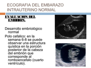 ECOGRAFIA DEL EMBARAZO
INTRAUTERINO NORMAL
EVALUACION DEL
EMBRION.
Desarrollo embriológico
normal
Polo cefalico: en la
semana 6-8 se puede
observar una estructura
quística en la porción
posterior de la cabeza
del embrión que
corresponde al
romboencefalo (cuarto
ventrículo).
 