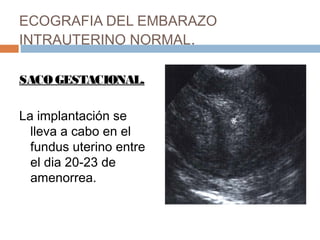 ECOGRAFIA DEL EMBARAZO
INTRAUTERINO NORMAL.
SACOGESTACIONAL.
La implantación se
lleva a cabo en el
fundus uterino entre
el dia 20-23 de
amenorrea.
 