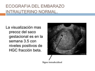 ECOGRAFIA DEL EMBARAZO
INTRAUTERINO NORMAL.
La visualización mas
precoz del saco
gestacional es en la
semana 3.5 con
niveles positivos de
HGC fracción beta.
Signo intradecidual
 