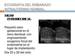 ECOGRAFIA DEL EMBARAZO
INTRAUTERINO NORMAL.
SIGNO
INTRADECIDUAL.
Pequeño saco
gestacional en el
seno decidual, con
engrosamiento
ecogenico focal del
endometrial en el
lugar de implantación.
Día 25 y 29 del ciclo.
 