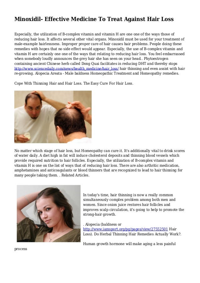 Minoxidil Effective Medicine To Treat Against Hair Loss