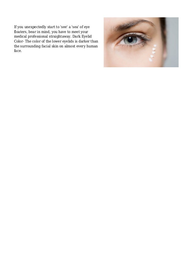 Ways to Eliminate Hereditary Dark Eye Circles