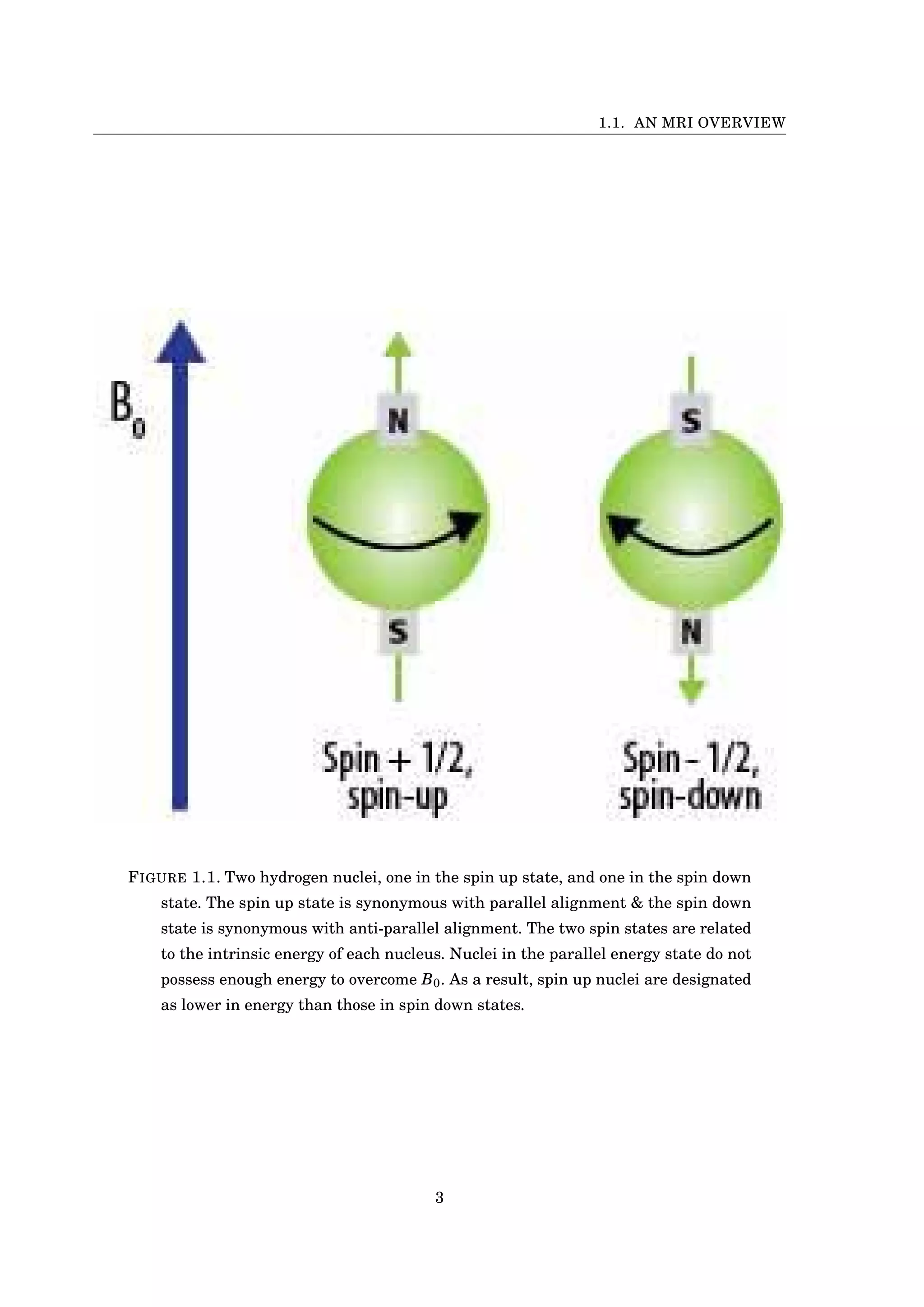 1.1. AN MRI OVERVIEW
FIGURE 1.1. Two hydrogen nuclei, one in the spin up state, and one in the spin down
state. The spin up state is synonymous with parallel alignment & the spin down
state is synonymous with anti-parallel alignment. The two spin states are related
to the intrinsic energy of each nucleus. Nuclei in the parallel energy state do not
possess enough energy to overcome B0. As a result, spin up nuclei are designated
as lower in energy than those in spin down states.
3
 