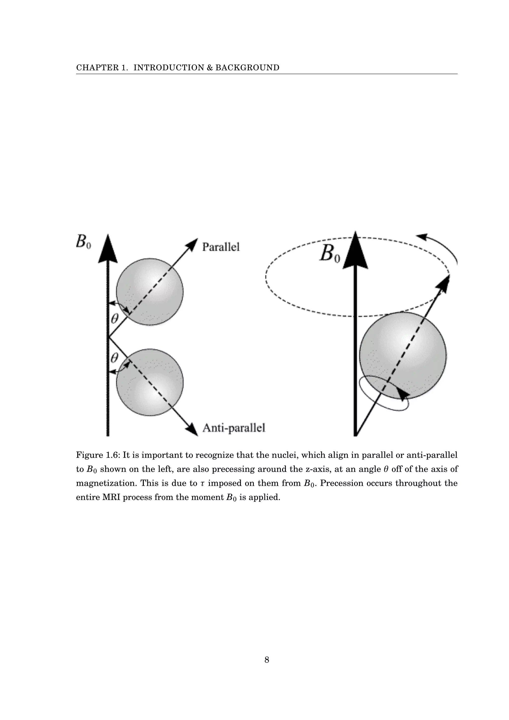 CHAPTER 1. INTRODUCTION & BACKGROUND
Figure 1.6: It is important to recognize that the nuclei, which align in parallel or anti-parallel
to B0 shown on the left, are also precessing around the z-axis, at an angle θ off of the axis of
magnetization. This is due to τ imposed on them from B0. Precession occurs throughout the
entire MRI process from the moment B0 is applied.
8
 