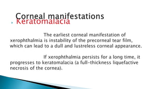  Keratomalacia
The earliest corneal manifestation of
xerophthalmia is instability of the precorneal tear film,
which can lead to a dull and lustreless corneal appearance.
If xerophthalmia persists for a long time, it
progresses to keratomalacia (a full-thickness liquefactive
necrosis of the cornea).
 
