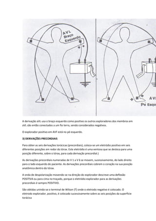 A derivação aVL usa o braço esquerdo como positivo os outros exploradores dos membros em
aVL são então conectados a um fio terra, sendo considerados negativos.
O explorador positivo em AVF está no pé esquerdo.
3) DERIVAÇÕES PRECORDIAIS
Para obter as seis derivações torácicas (precordiais), coloca-se um eletródio positivo em seis
diferentes posições em redor do tórax. Este eletródio é uma ventosa que se desloca para uma
posição diferente, sobre o tórax, para cada derivação precordial.)
As derivações precordiais numeradas de V 1 a V 6 se movem, sucessivamente, do lado direito
para o lado esquerdo do paciente. As derivações precordiais cobrem o coração na sua posição
anatômica dentro do tórax.
A onda de despolarização movendo-se na direção do explorador descreve uma deflexão
POSlTlVA ou para cima no traçado, porque o eletródio explorador para as derivações
precordiais é sempre POSITIVO.
São obtidas unindo-se o terminal de Wilson (T) onde o eletrodo negativo é colocado. O
eletrodo explorador, positivo, é colocado sucessivamente sobre as seis posições da superfície
torácica
 