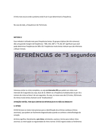 A linha mais escura onde a próxima onda R cair é que determinará a frequência.
No caso do lado, a frequência é de 75/minuto.
METODO 2
Esse método é utilizado mais para frequências lentas. Os grupos tríplices (de três números)
dão uma grande margem de freqüências. "300, 150, 100" e "75, 60, 50" significam que você
pode determinar freqüências de 300 a 50. Freqüências muito lentas indicam que são inferiores
a 60 por minuto.
Interessa contar os ciclos completos, ou seja os intervalos RR que podem ser vistos num
intervalo de 6 segundos (ou seja, duas de 3). Obtém-se a freqüência multiplicando-se por 10 o
número de ciclos na faixa 1 de seis segundos. Ou seja, no nosso caso são 2,9 ciclos, 29/minuto.
Os ritmos muito lentos chamam-se de "bradicardicos".
ATENÇÃO! ENTÃO, TEM QUE CONTAR OS INTERVALOS R-R E NÃO AS ONDAS R!!
II. RITMO
O ECG fornece os meios mais precisos para a identificação de arritmias cardíacas (ritmos
anormais), que podem ser facilmente diagnosticadas quando se conhece a eletrofisiologia do
coração.
Arritmia significa, literalmente, sem ritmo; entretanto, usamos o termo para indicar ritmo
anormal, ou interrupção na regularidade do ritmo normal. O ECG registra todos os fenômenos
 