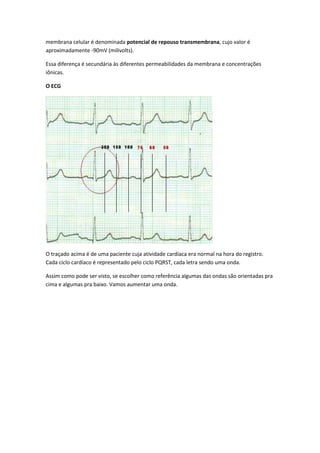 membrana celular é denominada potencial de repouso transmembrana, cujo valor é
aproximadamente -90mV (milivolts).
Essa diferença é secundária às diferentes permeabilidades da membrana e concentrações
iônicas.
O ECG
O traçado acima é de uma paciente cuja atividade cardíaca era normal na hora do registro.
Cada ciclo cardíaco é representado pelo ciclo PQRST, cada letra sendo uma onda.
Assim como pode ser visto, se escolher como referência algumas das ondas são orientadas pra
cima e algumas pra baixo. Vamos aumentar uma onda.
 