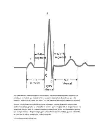 O traçado elétrico é a consequência dos correntes eletricos que se movimentam dentro do
coração, e, na medida que esse corrente se aproxima ou se afasta do eletrodo que esta
medindo, a deflexão do cursor que marca o ECG é pra cima (positivo) ou pra baixo (negativo).
Quando a onda de estimulação (despolarização) avança em direção ao eletródio positivo
(eletródio cutâneo), produz-se uma deflexão positiva (para cima) no ECG. A despolarização é a
progressão da uma onda de carga positiva dentro das células. Assim, a onda de carga positiva
que avança, durante a despolarização, gera uma deflexão positiva no ECG, quando esta onda
se move em direção a um detector cutâneo positivo.
Extrapolando para o ciclo acima:
 