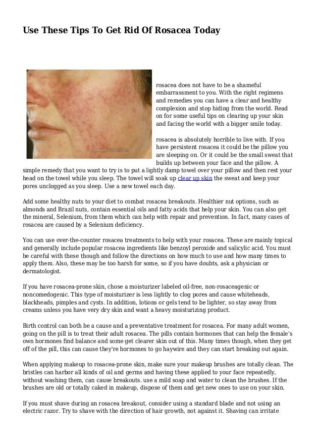 rosacea shaving