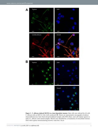www.nature.com/scientificreports/
5Scientific Reports | 5:12287 | DOI: 10.1038/srep12287
Figure 3.  C. albicans induced MCETs in a time-dependent manner. Mast cells were infected for 6 h with
C. albicans with an MOI 0.1 (A) or left uninfected (B). Shown are representative micrographs of indirect
immunofluorescence from fixed and permeabilized samples with DNA (blue), mast cell tryptase (green) as
well as C. albicans (red) stained samples. MCETs were identified by co-localization of extracellular laminar
DNA with tryptase immunostaining (arrows). Scale bars, 10 μ m.
 