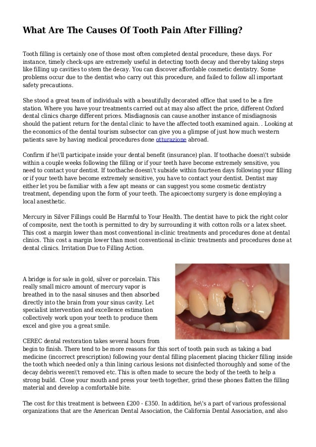 What Are The Causes Of Tooth Pain After Filling?