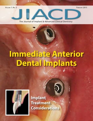 The Journal of Implant & Advanced Clinical Dentistry
Volume 7, No. 2	 February 2015
Implant
Treatment
Considerations
Immediate Anterior
Dental Implants
 