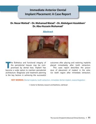 Immediate Anterior Dental Implant Placement:A Case Report | PDF