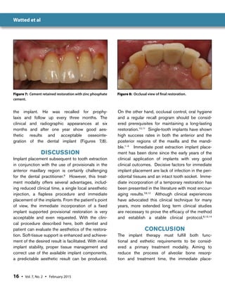 Immediate Anterior Dental Implant Placement:A Case Report | PDF