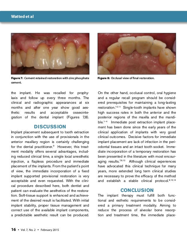 Immediate Anterior Dental Implant PlacementA Case Report