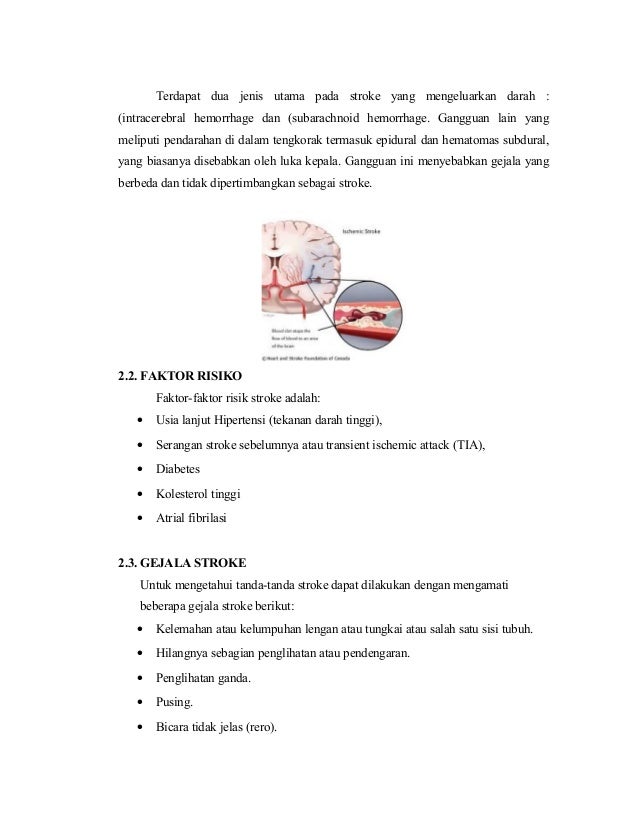 142423371 makalah-stroke-hemoragik