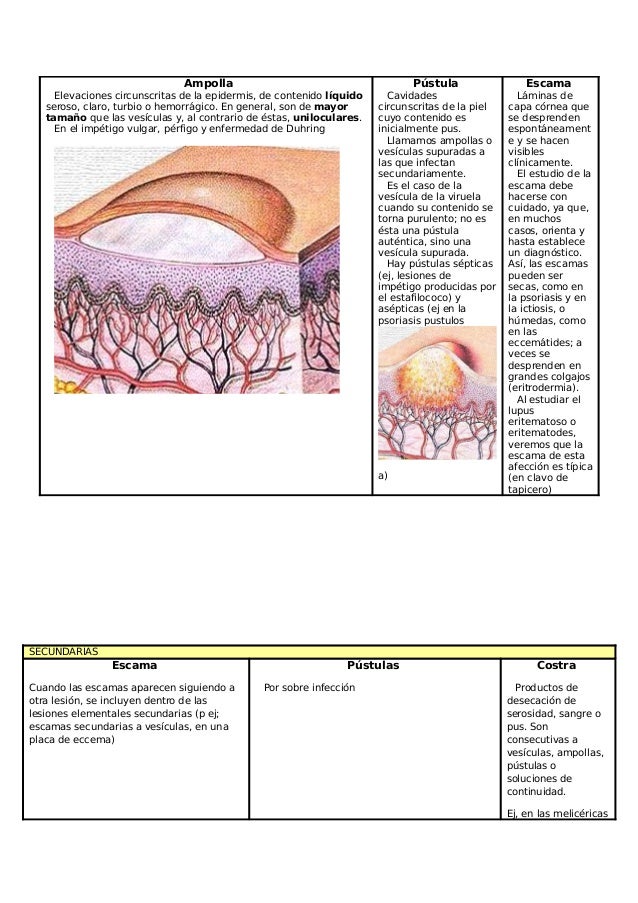 Sobre lo más importante el doctor de los carniceros sobre la psoriasis