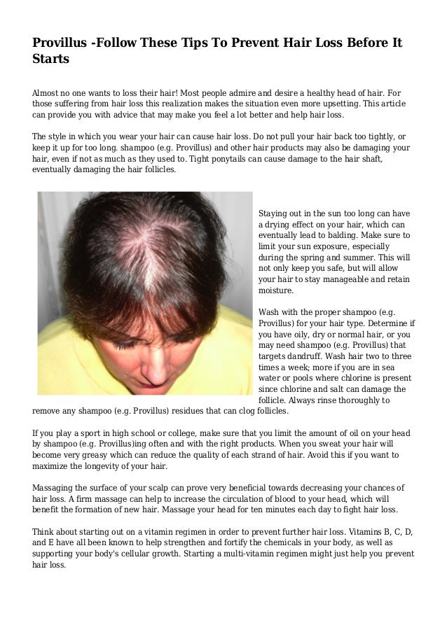 Provillus Follow These Tips To Prevent Hair Loss Before It Starts