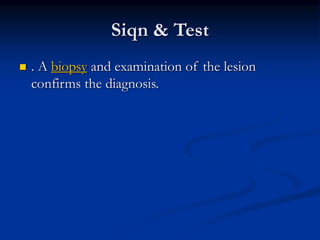 Siqn & Test
 . A biopsy and examination of the lesion
confirms the diagnosis.
 