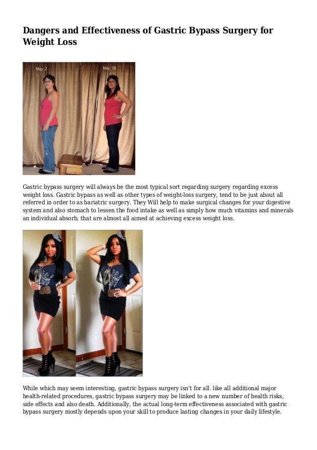 Dangers and Effectiveness of Gastric Bypass Surgery for Weight Loss