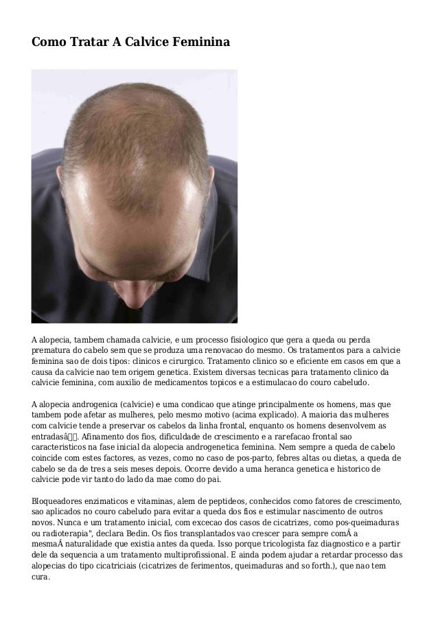 Como Tratar A Calvice Feminina