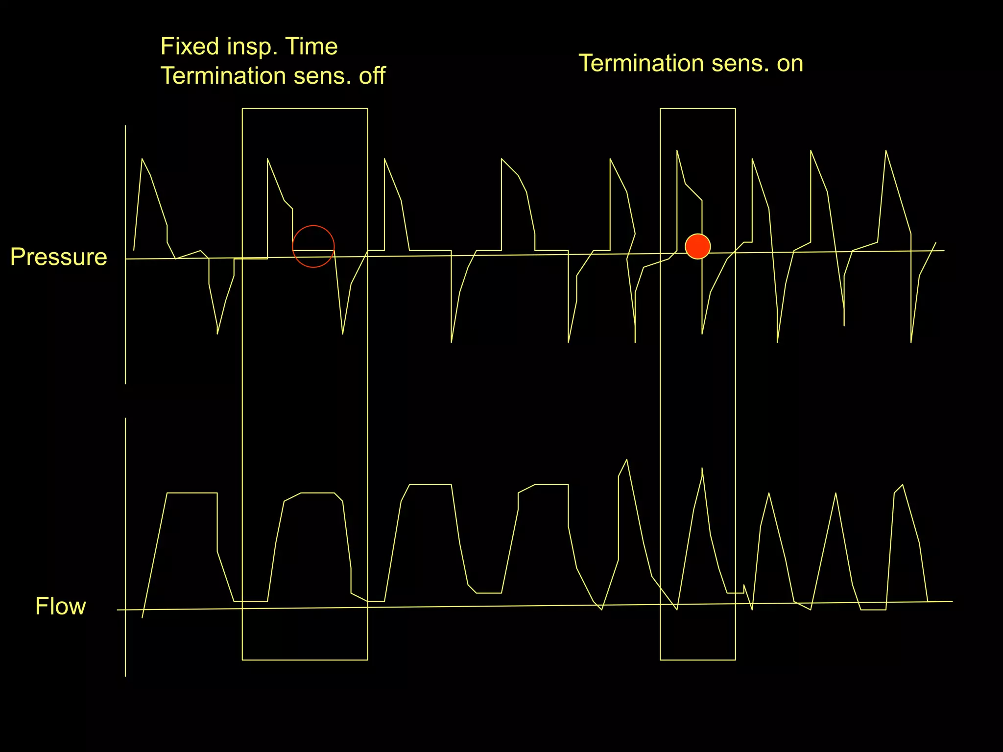 Fixed insp. Time
Termination sens. off
Termination sens. on
Flow
Pressure
 
