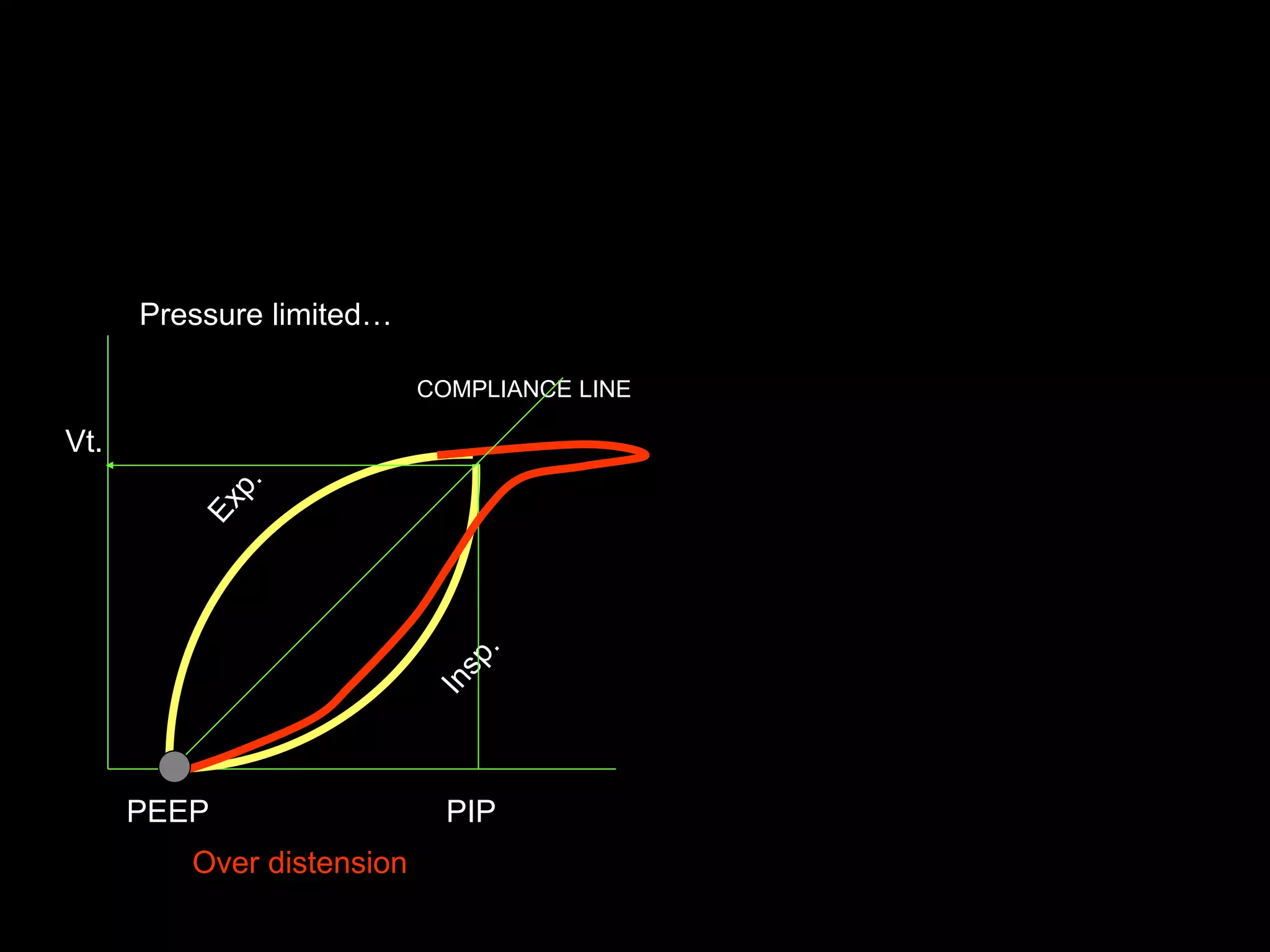 PEEP PIP
Vt.
COMPLIANCE LINE
Pressure limited…
Over distension
 