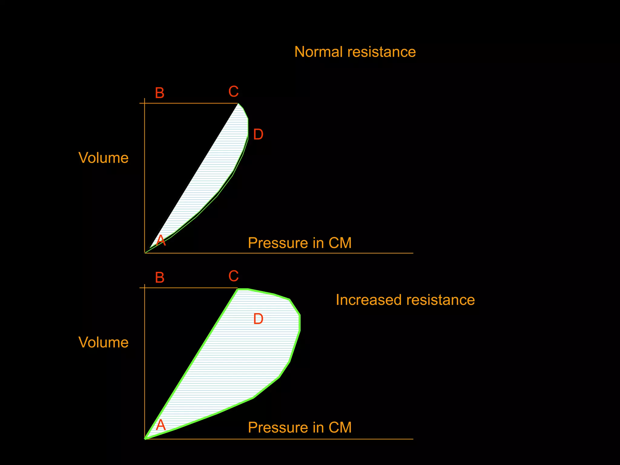 A
B C
D
Volume
Pressure in CM
B C
Volume
Pressure in CMA
D
Normal resistance
Increased resistance
 