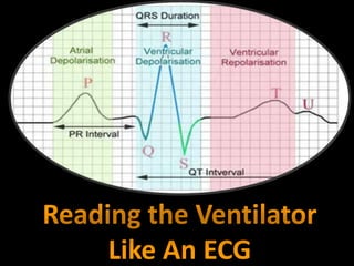 Reading the Ventilator
Like An ECG
 