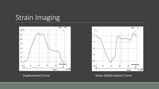Strain Imaging 
Displacement Curve Strain (Deformation) Curve 
 