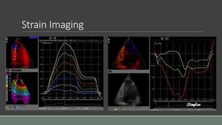 Strain Imaging 
 