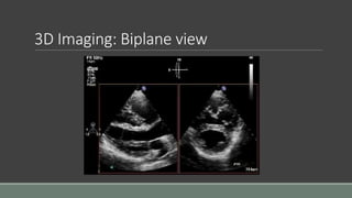 3D Imaging: Biplane view 
 