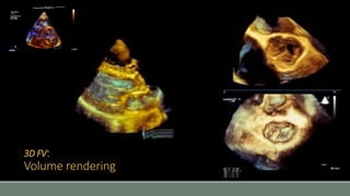3D FV: 
Volume rendering 
 