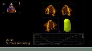 3D FV: 
Surface rendering 
 