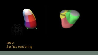 3D FV: 
Surface rendering 
 