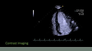 Contrast Imaging 
 