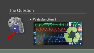 The Question 
 RV dysfunction ? 
• Previous RHF 
• Acidosis / CPR 
• High PEEP 
 
