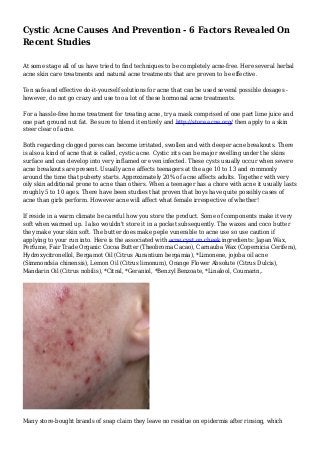 Cystic Acne Causes And Prevention - 6 Factors Revealed On
Recent Studies
At some stage all of us have tried to find techniques to be completely acne-free. Here several herbal
acne skin care treatments and natural acne treatments that are proven to be effective.
Ten safe and effective do-it-yourself solutions for acne that can be used several possible dosages -
however, do not go crazy and use too a lot of these hormonal acne treatments.
For a hassle-free home treatment for treating acne, try a mask comprised of one part lime juice and
one part ground nut fat. Be sure to blend it entirely and http://store.acne.org/ then apply to a skin
steer clear of acne.
Both regarding clogged pores can become irritated, swollen and with deeper acne breakouts. There
is also a kind of acne that is called, cystic acne. Cystic zits can be major swelling under the skins
surface and can develop into very inflamed or even infected. These cysts usually occur when severe
acne breakouts are present. Usually acne affects teenagers at the age 10 to 13 and commonly
around the time that puberty starts. Approximately 20% of acne affects adults. Together with very
oily skin additional prone to acne than others. When a teenager has a chore with acne it usually lasts
roughly 5 to 10 ages. There have been studies that proven that boys have quite possibly cases of
acne than girls perform. However acne will affect what female irrespective of whether!
If reside in a warm climate be careful how you store the product. Some of components make it very
soft when warmed up. I also wouldn't store it in a pocket subsequently. The waxes and coco butter
they make your skin soft. The butter does make peple vunerable to acne use so use caution if
applying to your run into. Here is the associated with acne cyst on cheek ingredients: Japan Wax,
Perfume, Fair Trade Organic Cocoa Butter (Theobroma Cacao), Carnauba Wax (Copernicia Cerifera),
Hydroxycitronellol, Bergamot Oil (Citrus Aurantium bergamia), *Limonene, jojoba oil acne
(Simmondsia chinensis), Lemon Oil (Citrus limonum), Orange Flower Absolute (Citrus Dulcis),
Mandarin Oil (Citrus nobilis), *Citral, *Geraniol, *Benzyl Benzoate, *Linalool, Coumarin,.
Many store-bought brands of soap claim they leave no residue on epidermis after rinsing, which
 