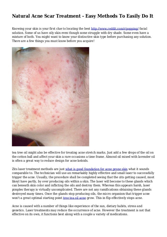 acne scar treatment for oily skin
