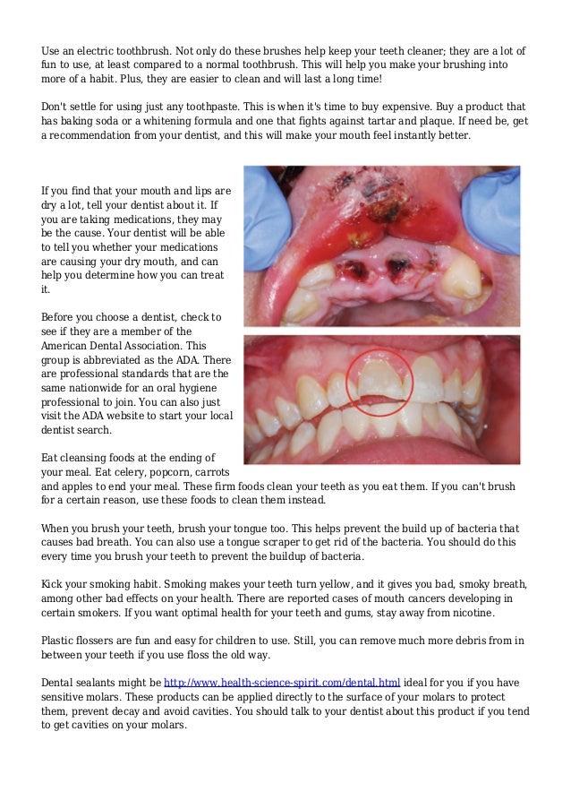 Take Better Care Of Your Mouth With These Concepts