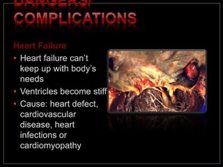 Heart Failure
• Heart failure can’t
keep up with body’s
needs
• Ventricles become stiff
• Cause: heart defect,
cardiovascular
disease, heart
infections or
cardiomyopathy
 