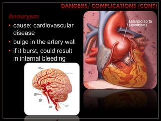 Aneurysm
• cause: cardiovascular
disease
• bulge in the artery wall
• if it burst, could result
in internal bleeding
 