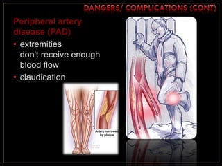 Peripheral artery
disease (PAD)
• extremities
don't receive enough
blood flow
• claudication
 