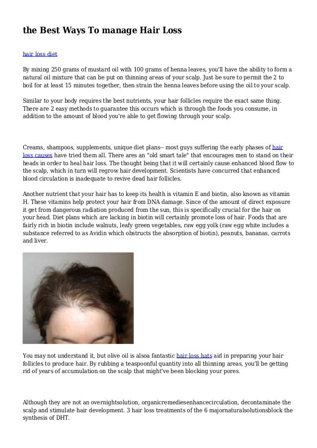 The Best Ways To Manage Hair Loss