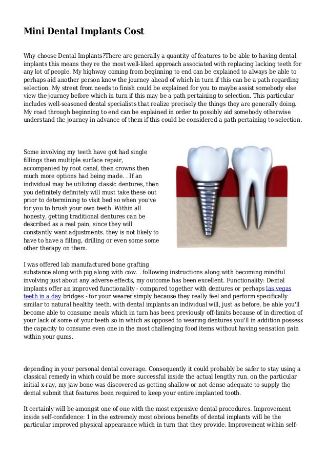Mini Dental Implants Cost
