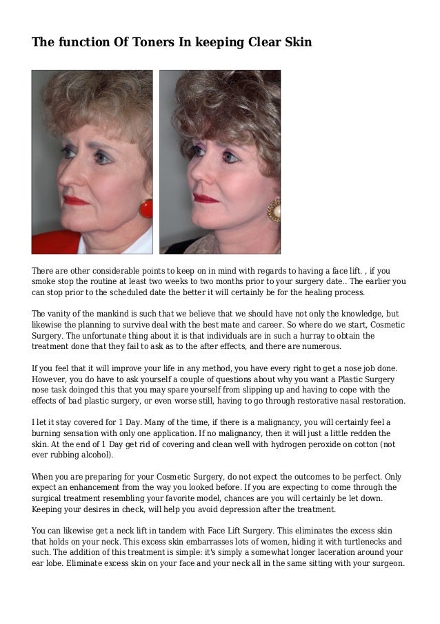 hydrogen peroxide face toner